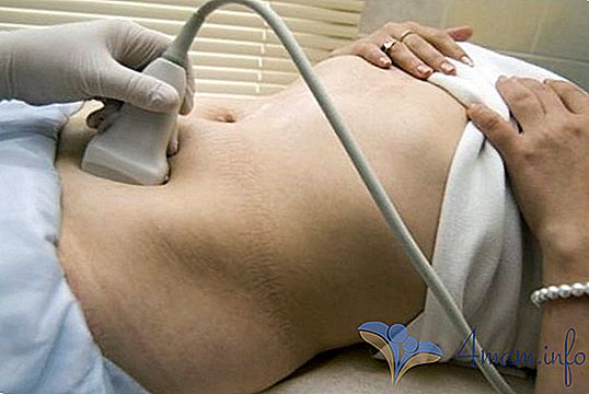 hipertenzija, fibroida pobačaj)